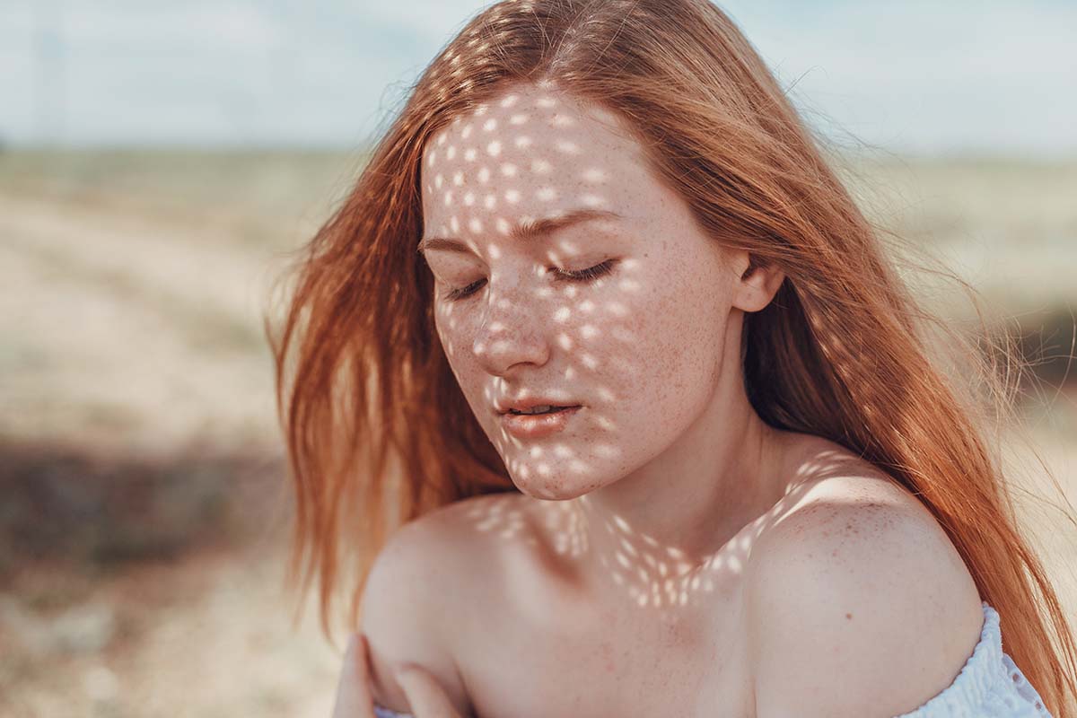 How To Cure White Spots On the Skin Caused by the Sun